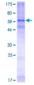 SDS-PAGE (CCR3-0691H).jpg